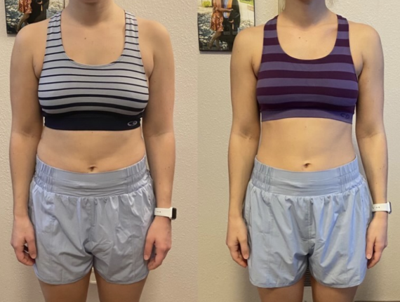 Before and after image 